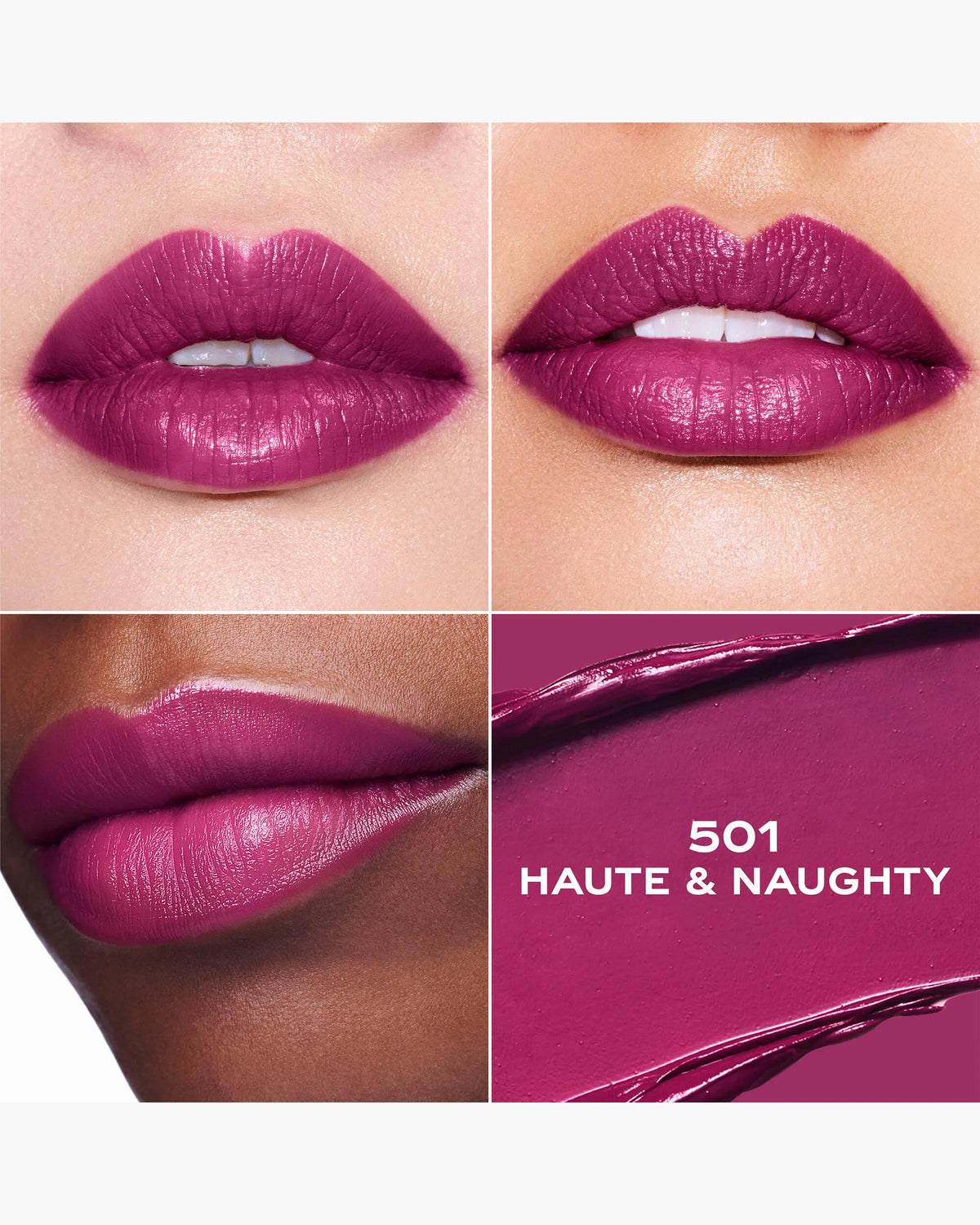 Labial
