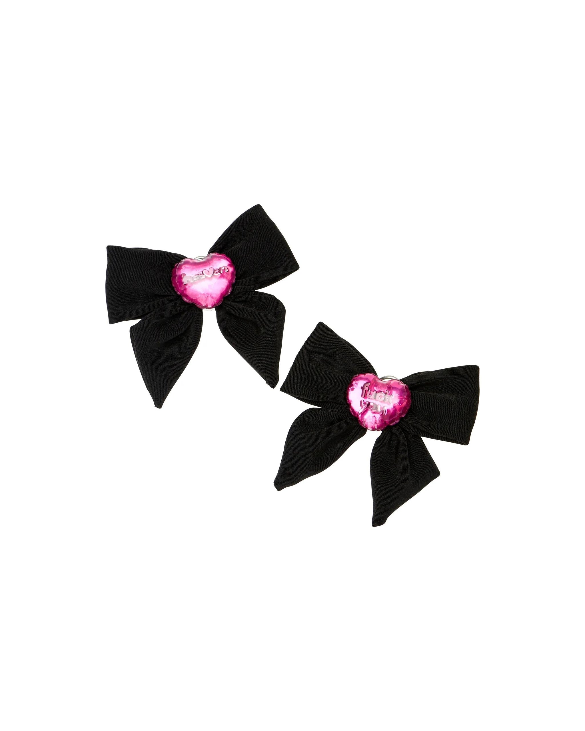Aretes