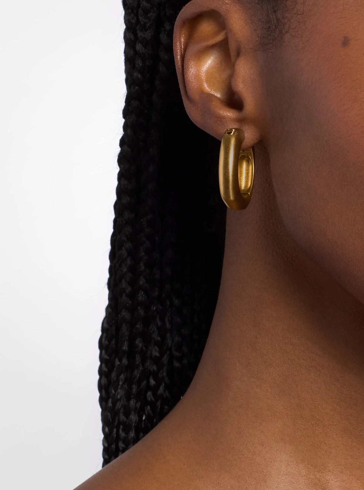 Aretes