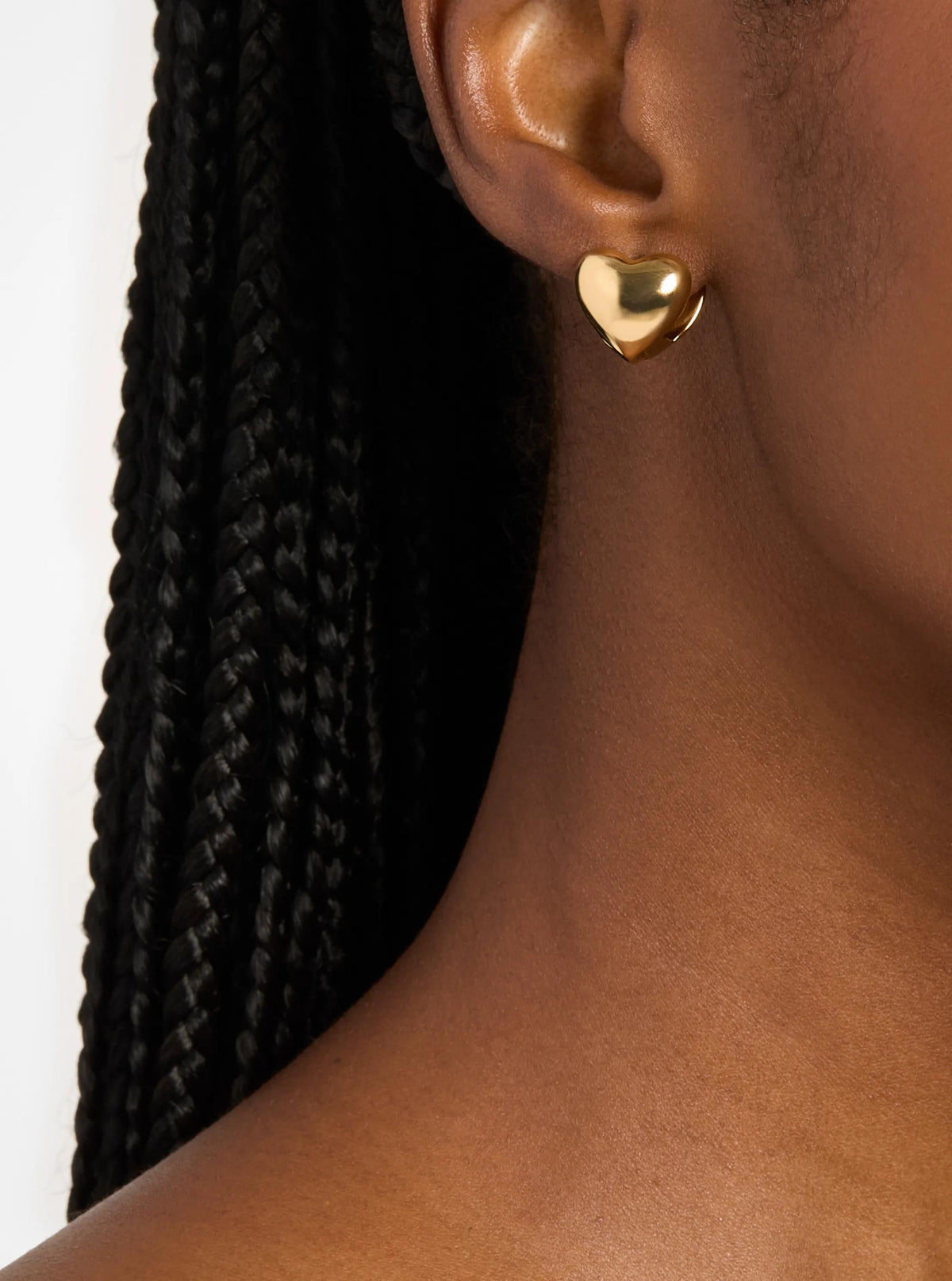 Aretes